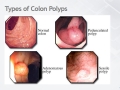 slide19