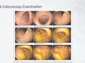 slide39