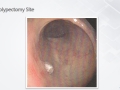 slide43