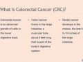 colon-for-physicians_page_06