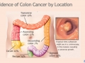 colon-for-physicians_page_22